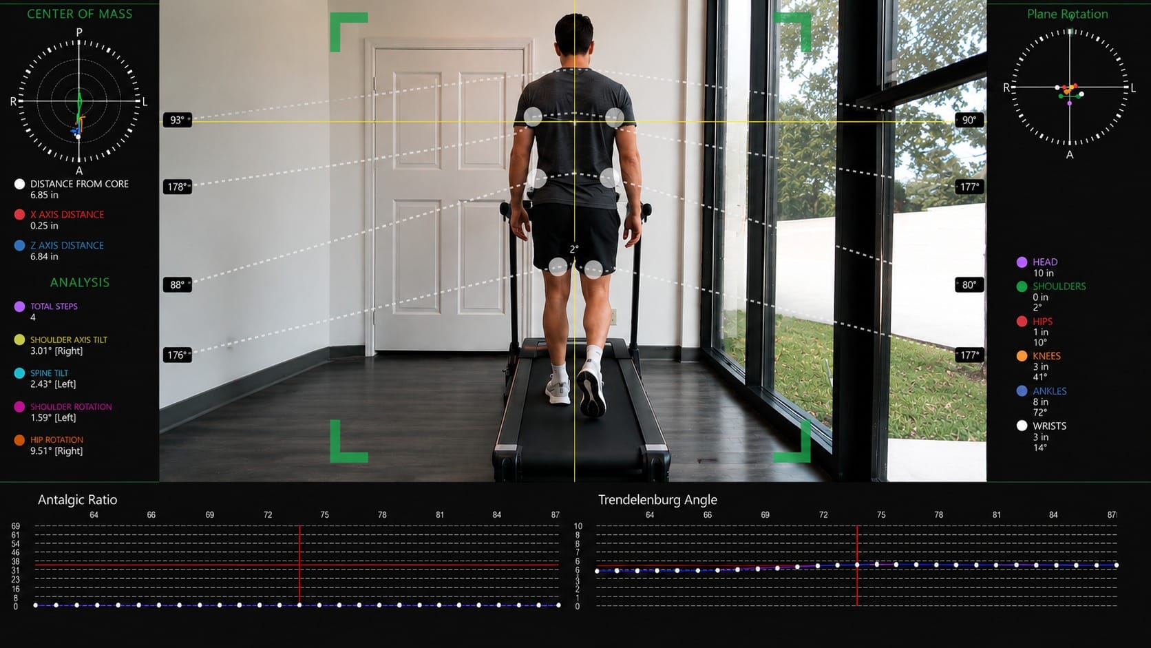 Kinetisense gait analysis software showing real-time joint angle, center of mass, and gait symmetry data during a treadmill assessment